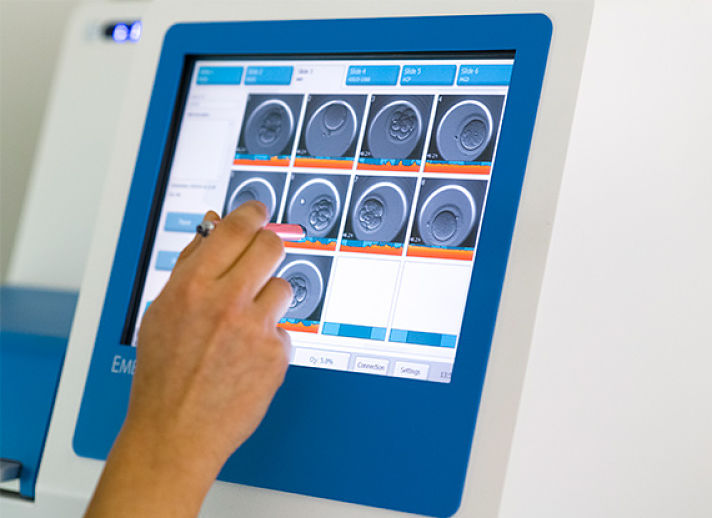 Que-es-embryoscope